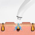 The Clarity Pore Tool